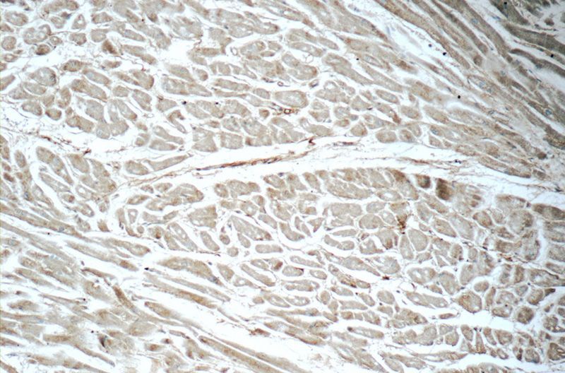 Immunohistochemistry of paraffin-embedded human heart tissue slide using Catalog No:112358(LTB4R Antibody) at dilution of 1:50 (under 10x lens)