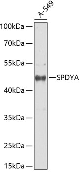 Western blot - SPDYA Polyclonal Antibody 