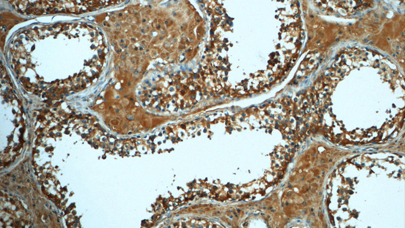 Immunohistochemistry of paraffin-embedded human testis tissue slide using Catalog No:108304(ATP6V1A Antibody) at dilution of 1:50 (under 10x lens)