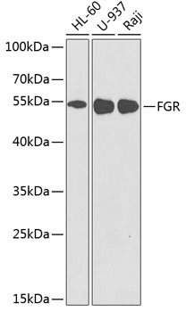 Western blot - FGR Polyclonal Antibody 