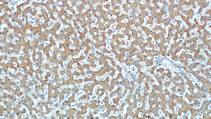 Immunohistochemical of paraffin-embedded human liver using Catalog No:107641(TKT antibody) at dilution of 1:50 (under 10x lens)