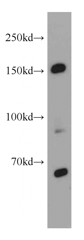 HT-1080 cells were subjected to SDS PAGE followed by western blot with Catalog No:115903(TCERG1 antibody) at dilution of 1:2000