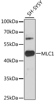 Western blot - MLC1 Polyclonal Antibody 