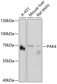 Western blot - PAK4 Polyclonal Antibody 