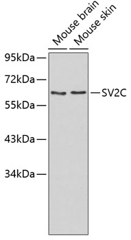 Western blot - SV2C Polyclonal Antibody 