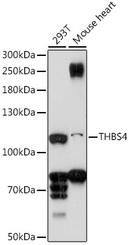 Western blot - THBS4 Polyclonal Antibody 