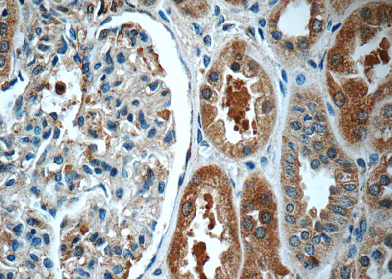Immunohistochemistry of paraffin-embedded human kidney tissue slide using Catalog No:110296(ECOP Antibody) at dilution of 1:50 (under 40x lens)