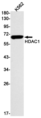 Western blot detection of HDAC1 in K562 cell lysates using HDAC1 Rabbit mAb(1:1000 diluted).Predicted band size:55kDa.Observed band size:62kDa.
