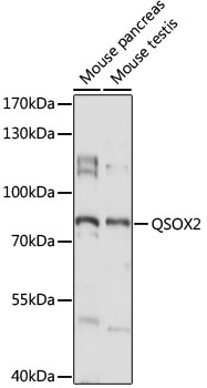Western blot - QSOX2 Polyclonal Antibody 
