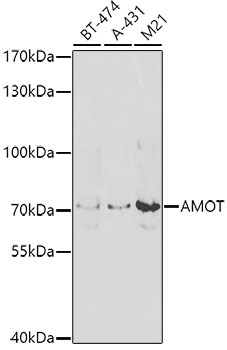 Western blot - AMOT Polyclonal Antibody 
