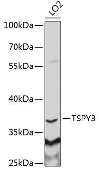 Western blot - TSPY3 Polyclonal Antibody 