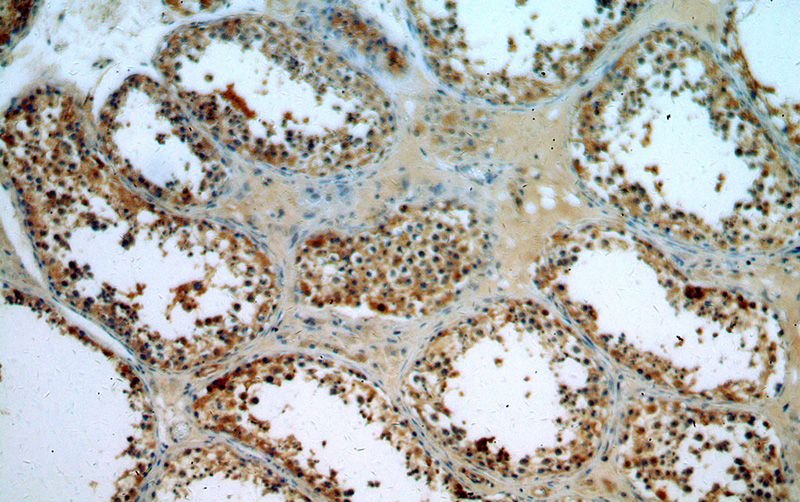 Immunohistochemical of paraffin-embedded human testis using Catalog No:109620(CSTL1-Specific antibody) at dilution of 1:50 (under 10x lens)