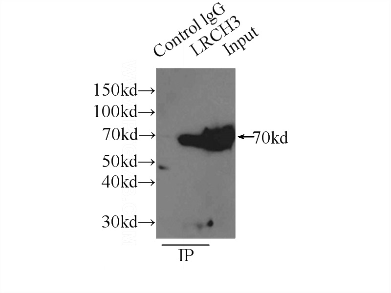 IP Result of anti-LRCH3 (IP:Catalog No:112316, 3ug; Detection:Catalog No:112316 1:1000) with mouse liver tissue lysate 12500ug.