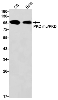 Western blot detection of PKC mu/PKD in C6,Hela cell lysates using PKC mu/PKD Rabbit mAb(1:1000 diluted).Predicted band size:102kDa.Observed band size:102kDa.
