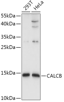 Western blot - CALCB Polyclonal Antibody 