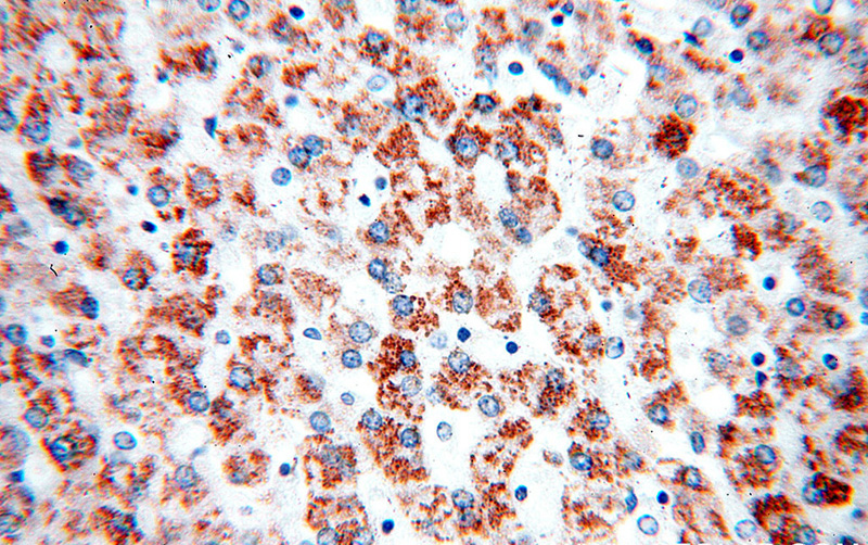 Immunohistochemical of paraffin-embedded human liver using Catalog No:107949(AKT2 antibody) at dilution of 1:100 (under 40x lens)
