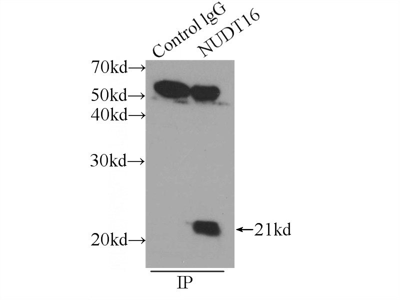 IP Result of anti-NUDT16 (IP:Catalog No:113357, 3ug; Detection:Catalog No:113357 1:1000) with HEK-293 cells lysate 2400ug.