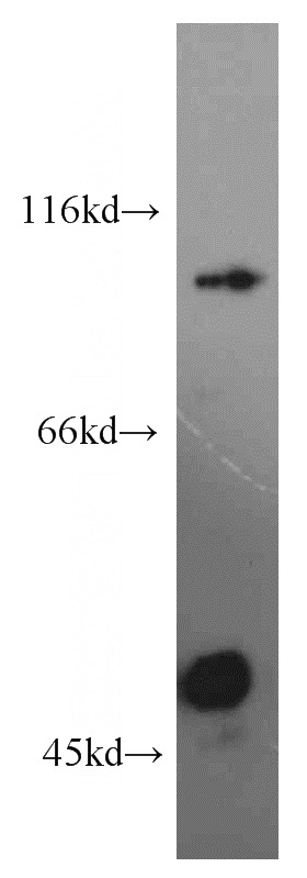 HeLa cells were subjected to SDS PAGE followed by western blot with Catalog No:115251(SIX4 antibody) at dilution of 1:300