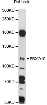 Western blot - FBXO10 Polyclonal Antibody 