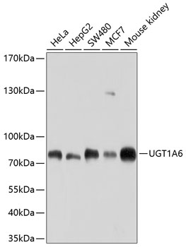 Western blot - UGT1A6 Polyclonal Antibody 