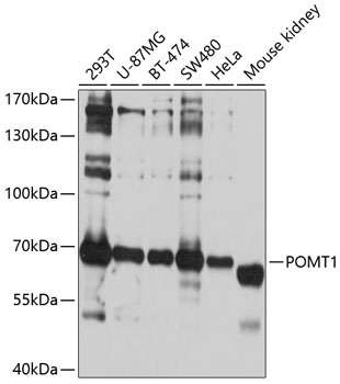 Western blot - POMT1 Polyclonal Antibody 