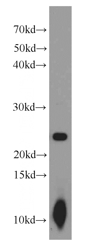 mouse brain tissue were subjected to SDS PAGE followed by western blot with Catalog No:112801(MRAS antibody) at dilution of 1:300