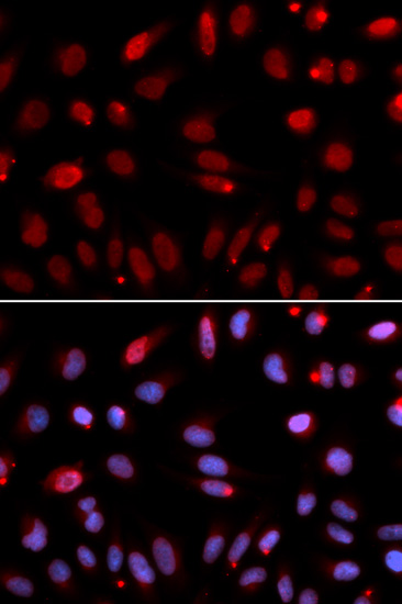 Immunofluorescence - HUS1 Polyclonal Antibody 