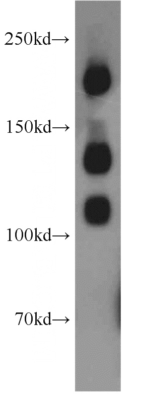 mouse brain tissue were subjected to SDS PAGE followed by western blot with Catalog No:113027(NCAM1 antibody) at dilution of 1:300