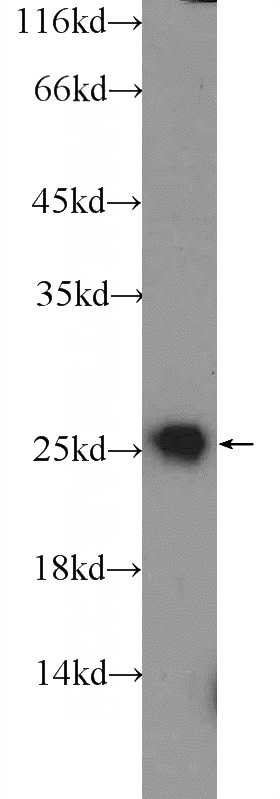 mouse spleen tissue were subjected to SDS PAGE followed by western blot with Catalog No:111632(IGJ Antibody) at dilution of 1:300