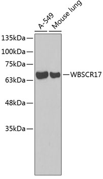 Western blot - WBSCR17 Polyclonal Antibody 