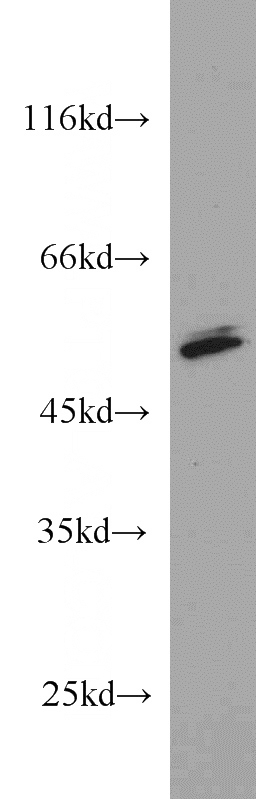 K-562 cells were subjected to SDS PAGE followed by western blot with Catalog No:114197(PRKAR2A antibody) at dilution of 1:1000