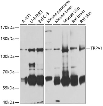 Western blot - TRPV1 Polyclonal Antibody 