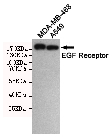 Western blot detection of EGFR in A549 and MDA-MB-468 cell lysates using EGFR mouse mAb(dilution 1:1000).Predicted band size:134 Kda.Observed band size:175KDa.