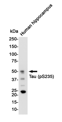 Western blot detection of Tau (Phospho-Ser235) in Human Hippocampus lysates using Tau (Phospho-Ser235) Rabbit pAb(1:1000 diluted).Predicted band size:79KDa.Observed band size:50-80KDa.