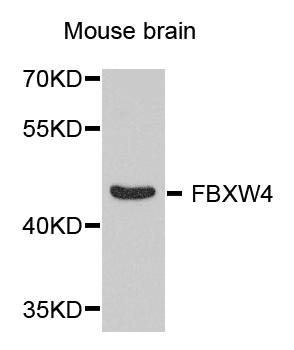 Western blot - FBXW4 Polyclonal Antibody 