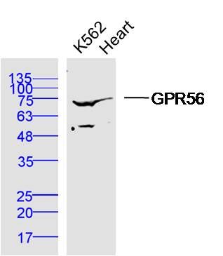 Fig1: Sample:; K562 Cell (Human) Lysate at 40 ug; Heart (Mouse) Lysate at 40 ug; Primary: Anti-GPR56 at 1/300 dilution; Secondary: IRDye800CW Goat Anti-Rabbit IgG at 1/20000 dilution; Predicted band size: 78 kD; Observed band size: 75 kD