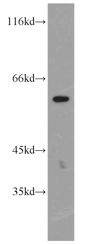 SH-SY5Y cells were subjected to SDS PAGE followed by western blot with Catalog No:113117(NETO2 antibody) at dilution of 1:500