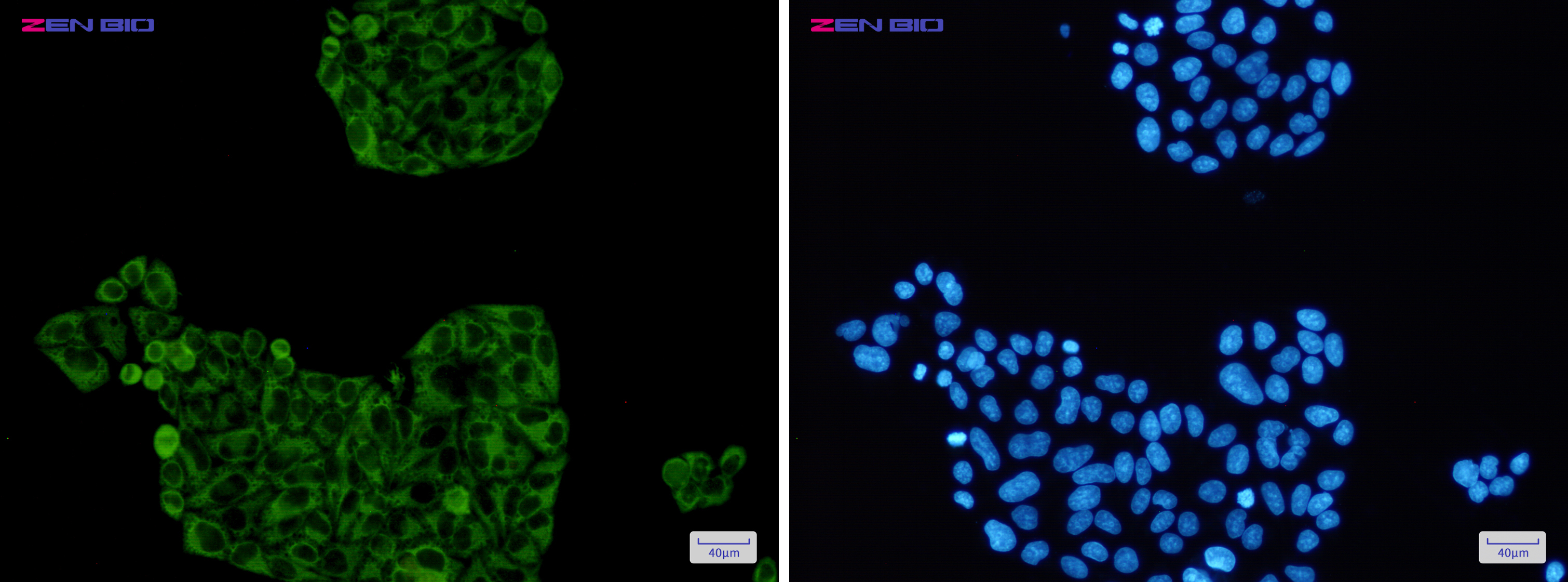 Immunocytochemistry of PFKP(green) in Hela cells using PFKP Rabbit pAb at dilution 1/50, and DAPI(blue)