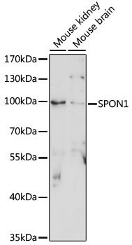 Western blot - SPON1 Polyclonal Antibody 