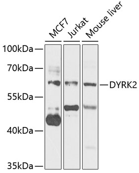 Western blot - DYRK2 Polyclonal Antibody 