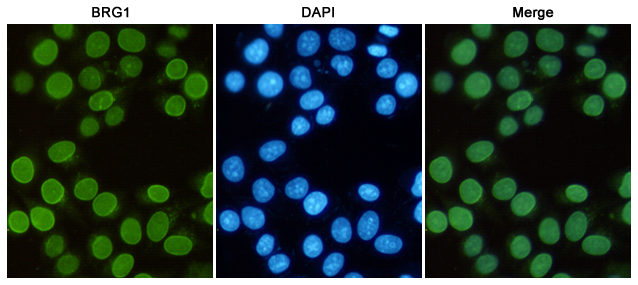 Immunofluorescent analysis of Hela cells fixed with 4% Paraformaldehyde and using anti-BRG1 mouse mAb (dilution 1:50). DAPI was used to stain nucleus(blue).