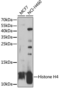 Western blot - Histone H4 Polyclonal Antibody 