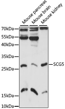 Western blot - SCG5 Polyclonal Antibody 