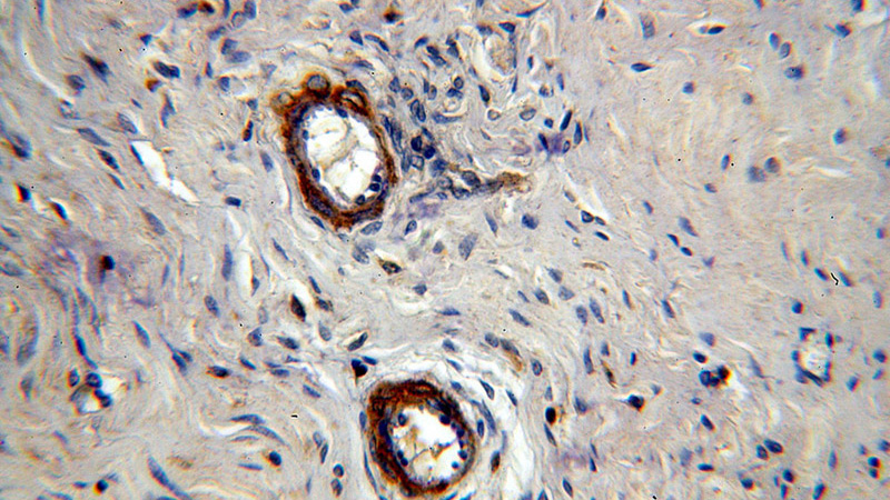 Immunohistochemical of paraffin-embedded human ovary using Catalog No:112269(LAMA4 antibody) at dilution of 1:100 (under 40x lens)