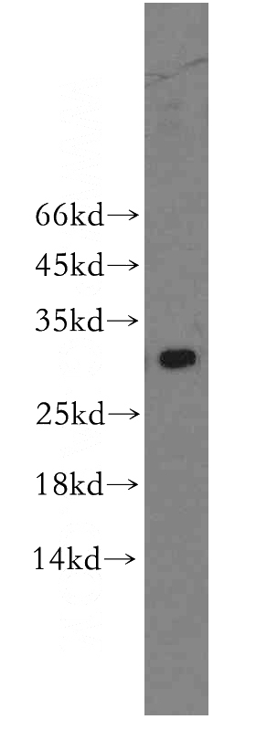 U-937 cells were subjected to SDS PAGE followed by western blot with Catalog No:111762(IL17A antibody) at dilution of 1:500