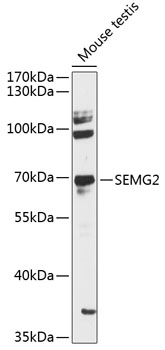 Western blot - SEMG2 Polyclonal Antibody 