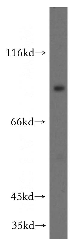human placenta tissue were subjected to SDS PAGE followed by western blot with Catalog No:109996(DLL1-Specific antibody) at dilution of 1:300