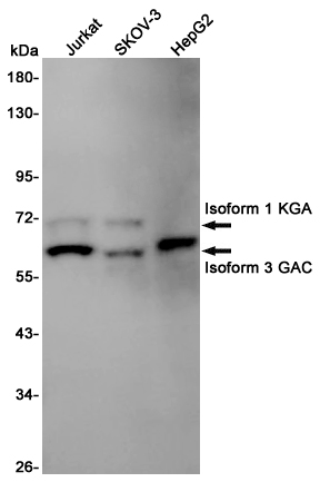 Western blot detection of Glutaminase-1/GLS1 in Jurkat,SKOV-3,HepG2 cell lysates using Glutaminase-1/GLS1 Rabbit pAb(1:1000 diluted).Predicted band size:73KDa.Observed band size:73,65KDa.