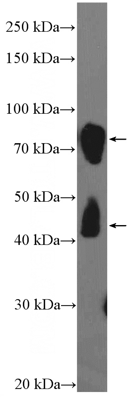 rat brain tissue were subjected to SDS PAGE followed by western blot with Catalog No:109751(DCLK1 Antibody) at dilution of 1:1500