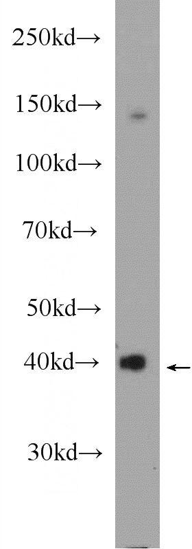 mouse liver tissue were subjected to SDS PAGE followed by western blot with Catalog No:111336(HAO1 Antibody) at dilution of 1:600